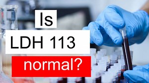 Is LDH 113 normal, high or low? What does Lactate dehydrogenase level 113 mean?