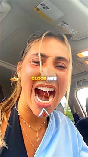 Her Jaw Got Stuck Open…😱💀