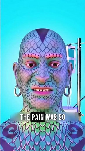 Man who transformed himself into a lizard 🦎 #shortsfeed #facts