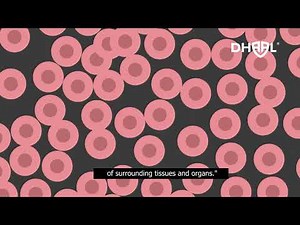 Harmful effects of Ionizing Radiation on Human Body