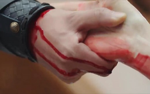 【受伤】男主英雄救美，旧伤流血仍不放手