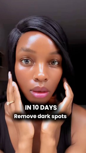 865K views · 10K reactions | Remove dark spots in 10 days. Do this! | Aroma Talks | Facebook