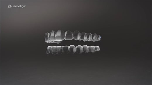 How Invisalign Treatment Works