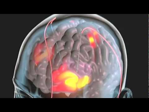 Real World: Heart Rate and Blood Pressure