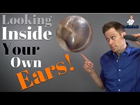 What's Inside Your Ears? | Clogged Ears & Ear Problems | Natus Otocam 300