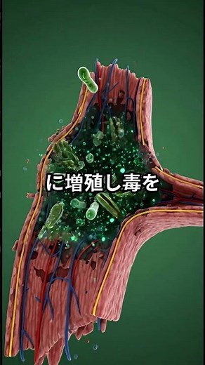 もし錆びた釘を踏んだら、あなたの体はどうなるのか？ #破傷風 #体の仕組み #応急手当