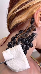 11M views · 21K reactions | Small insects are wiped off a neck by...