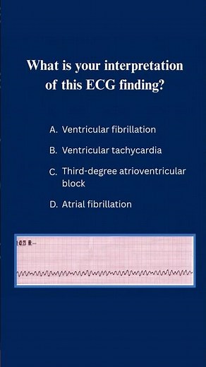 ACLS Practice Test Question 6 | Can you read this ECG? #acls #aclscertification #shorts