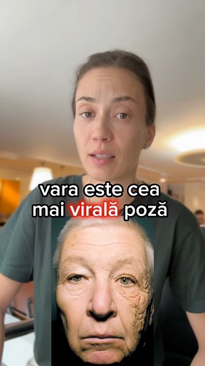 35K views · 515 reactions | Azi vorbim despre spaima de soare si...