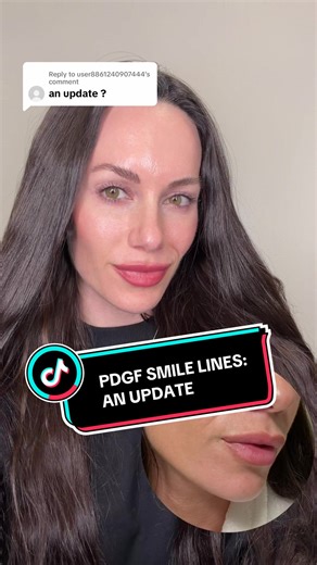 PDGF for Smile Lines: One Year Update