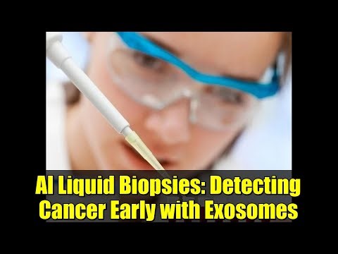 AI Liquid Biopsies: Detecting Cancer Early with Exosomes