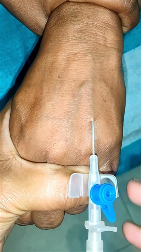 How to insert cannula properly nursing students must watch #ytshorts #trending #viralvideo #nursing