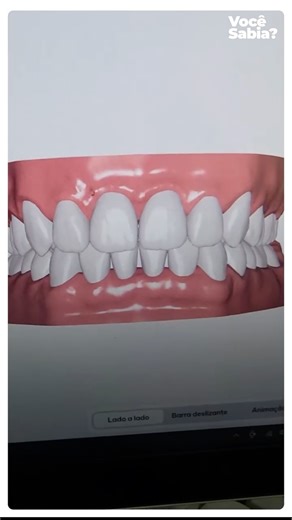 Dentsply Sirona Brasil on Instagram: "Com Primescan + DS Core, vamos muito além de um escaneamento preciso. Dentro do DS Core, o SureSmile Simulator permite simular, de forma rápida e intuitiva, como será o sorriso do paciente após o tratamento. O paciente visualiza o possível resultado final, entende melhor a importância do tratamento e se sente parte ativa do planejamento — o que gera mais confiança, engajamento e previsibilidade clínica. 📲 Tecnologia que conecta diagnóstico, planejamento e e
