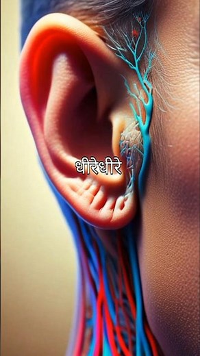 Sensorineural Hearing loss - Prevention is better than cure