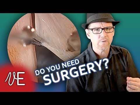 Vocal Fold Cyst: Diagnosis, Care and Treatment for Singers | #DrDan 🎤