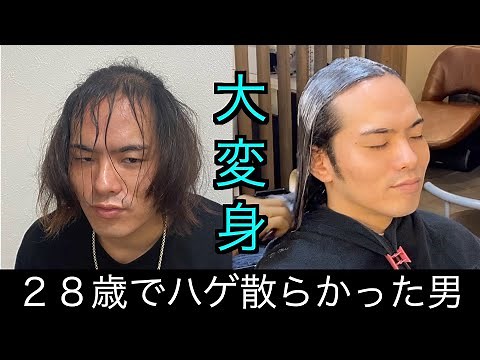 【ハゲ】髪を伸ばし続けた薄毛男子が念願のストパーで大変身