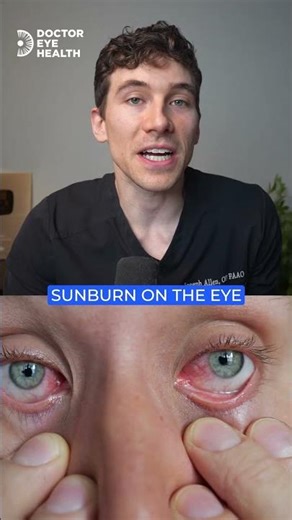 Snow and Water Are Secretly Burning Your Eyes #uvdamage #uvlight