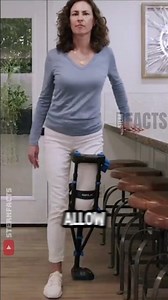 Move Easily Like With a Modern Prosthetic