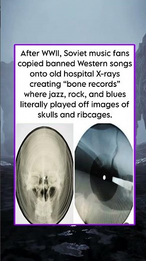 After WWII, Soviet music fans copied banned Western songs onto old hospital X-rays creating