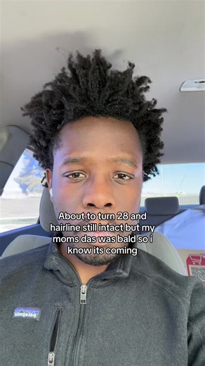 Embracing My Hairline at 28: Natural Insights