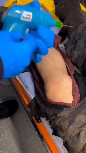 605K views · 855 reactions | Who can name this IO placement?  | Paramedic Flash | Facebook