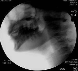 TalkTools workshops teach you innovative speech & feeding techniques that can be used the very next day. Over 5000 speech therapists across the world attend TalkTools training (live and self study) each year. This September in Watertown, SD! | TalkTools