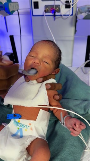 214K views · 8.9K reactions | On the fourth day, your baby is making great progress with sucking and feeding - keep up the fantastic work殺❤️ #baby #cutebaby #newborn #docter #afterbirth #nicu #feeding | Inderpal Yadav | Facebook