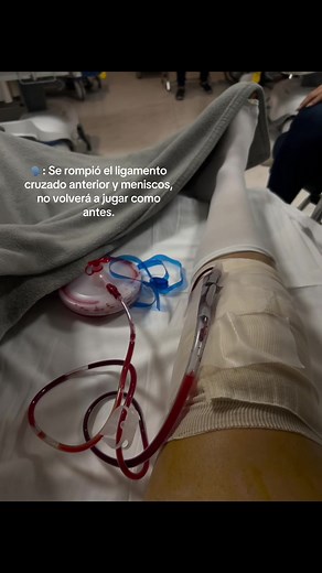 Loading🔋 #fyp #paratiiiiiiiiiiiiiiiiiiiiiiiiiiiiiii #lesion #lca #futebol