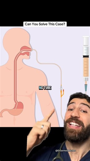 Dr Sermed Mezher MBChB (hons), MRes, MRCGP (2023) on Instagram: "Can You Find the NG Tube? #test Sources: PMID 40896069 Nasogastric (NG) tubes are invaluable tools in clinical settings, providing a direct “bypass” to the stomach for patients who cannot swallow safely or require immediate decompression. They are essential for delivering life-sustaining nutrition and medication to those with neurological impairments or those on ventilators. Additionally, in emergency cases like a bowel obstruction