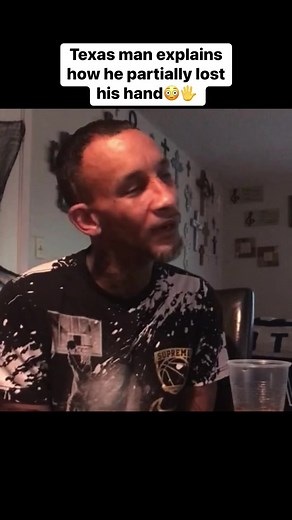 Texas Man Explains How He Partially Lost His Hand😳🖐 The Life Story of Smitty! Watch Here👇 https://youtu.be/dCBZCraysc0?si=nE5_yi67SbN8YKPA | HBMtv