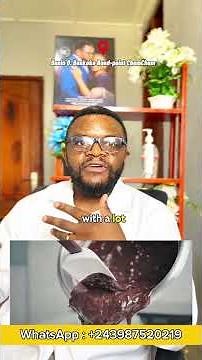 Les causes des boutons du visage. #skincare #cosmeticdermatology #beauty #skincareroutine