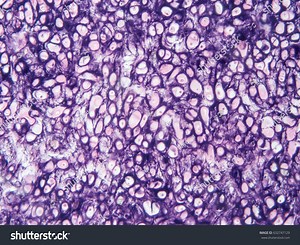 Histology Human Cartilage Connective Tissue Show Stock Photo 632747129 | Shutterstock