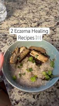 2 Eczema Healing Recipes #eczema