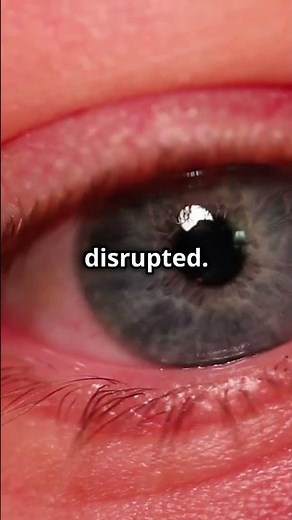 Why Horner's syndrome causes miosis explained! #mbbs