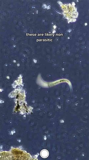 Under the Microscope: The Hidden World You’ve Never Seen