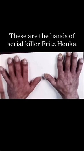 180K views · 86 reactions | Hands of German serial killer Fritz...
