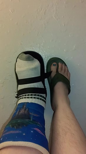 Leg Casts and Sock Styles: A Fun TikTok Trend