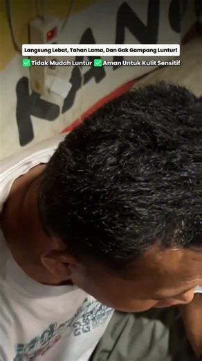 Rambut Terlihat Jarang? Atasi Sekarang