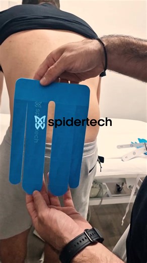 14K views · 42 reactions | No more guesswork! Taping for lower back is now simpler than ever with our user-friendly guide and specialized tape.  #TapingSimplified | Spidertech | Facebook