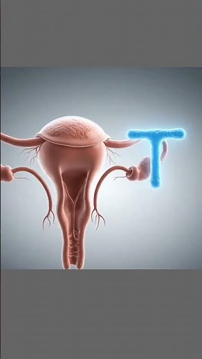 How IUD Prevents Pregnancy? 💡 | 3D Medical Animation #preventivedentistry #pregnancy