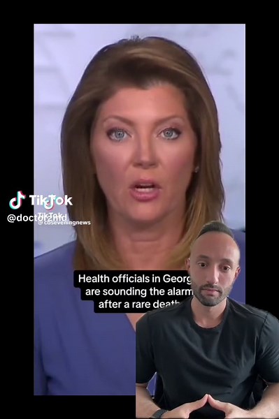 Naegleria fowleri: an amoeba found in warm freshwater. It's often called the 'brain-eating amoeba, and though rare, it's deadly. Entering through the nose, it can cause Primary Amebic Meningoencephalitis (PAM), a devastating brain infection. The CDC reports a fatality rate of over 97%, with only 4 survivors in the U.S. from 1962 to 2019. Always use nose plugs in warm freshwater or improperly chlorinate pools to minimize risk. Knowledge is power in preventing tragedy. 🦠 🧠 👨‍⚕️ #neurosurgeon #m