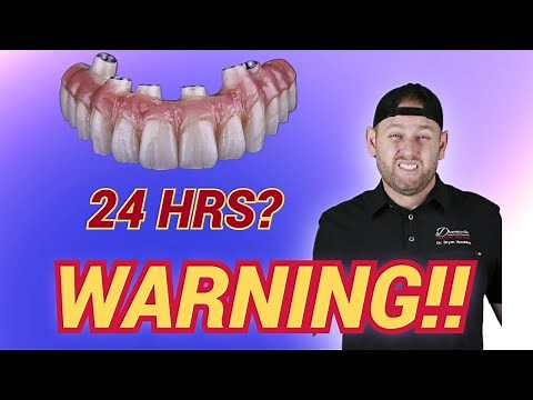 WARNING!! ALL-ON-4 TEETH IN 24HRS!!!
