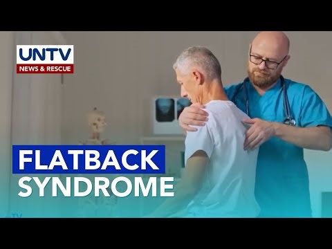 FLATBACK SYNDROME: Causes, Prevention, and Treatment