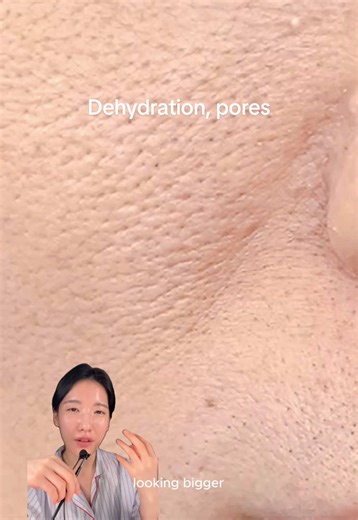 For dehydration lines visible pores this PDRN combo is it - @mediheal_global’s PDRN Lifting Derma Cream Ad) & PDRN Lifting Pads You can get it with a special discount on Olive Young Global from Jan 12–31st! #mediheal #koreanskincare #veganpdrn #dermacream #oliveyoungmusthave