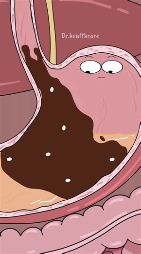 What Happens If You Eat Mentos and Drink Coke? | mentos