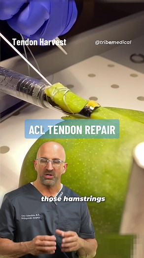 ACL Reconstruction: Autograft & Allograft Options