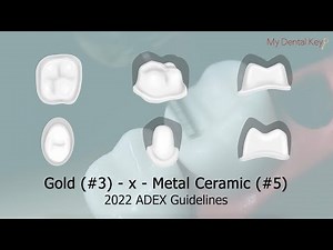 PASS THE CDCA - 3-x-5 Fixed Partial Denture Preparation | My Dental Key