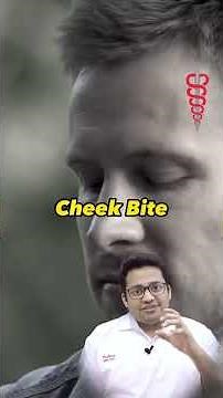 Third Molar Extraction | Resolving Space and Alignment Issues | Wisdom Tooth Extraction