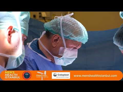 Understanding Coloplast Titan Touch Penile Prosthesis Implantation with Professor Ates Kadioglu