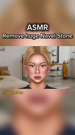 Remove huge Navel Stone Cleaning #asmr #treatment #care #navel #satisfyingvideos